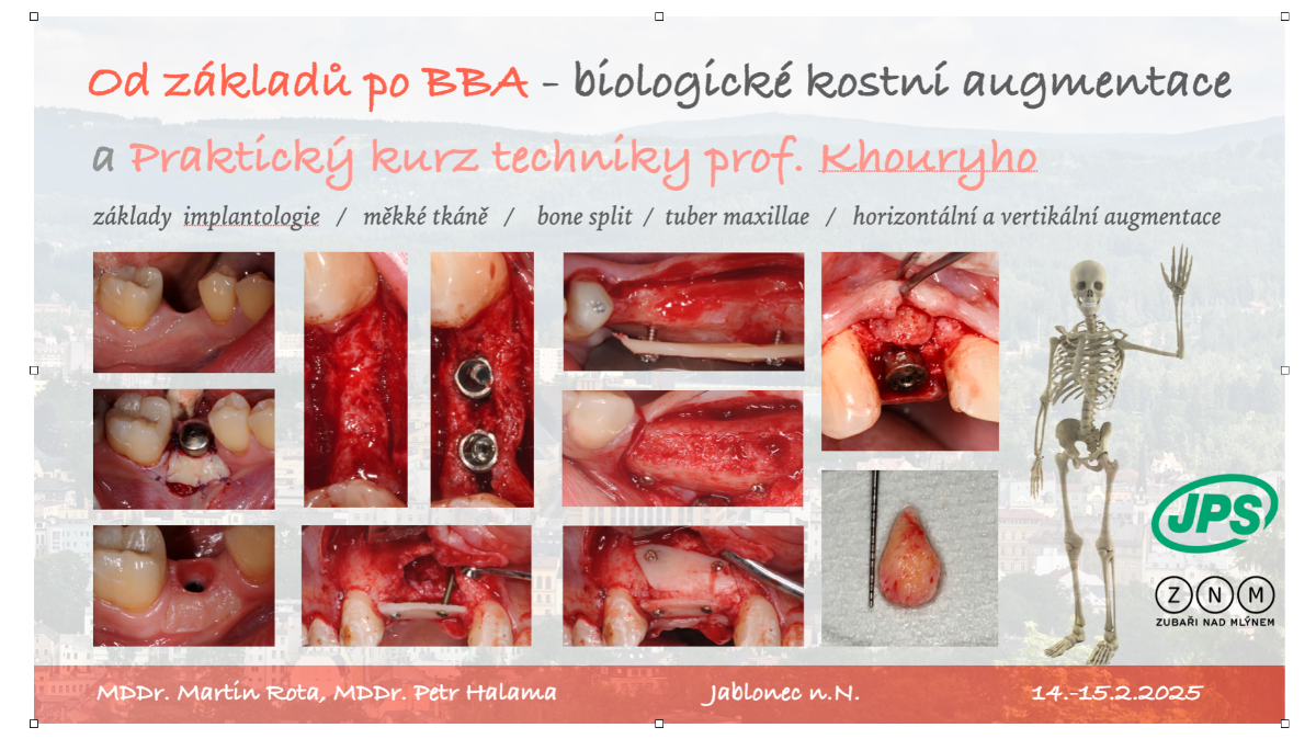 Od základů k BBA - 14-15.2.2025